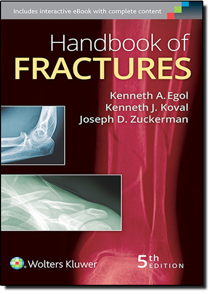 Handbook of Fractures, livro de Kenneth A. Egol