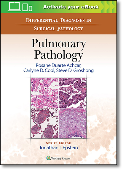 Differential Diagnosis in Surgical Pathology: Pulmonary Pathology, livro de Rosane Duarte Achcar