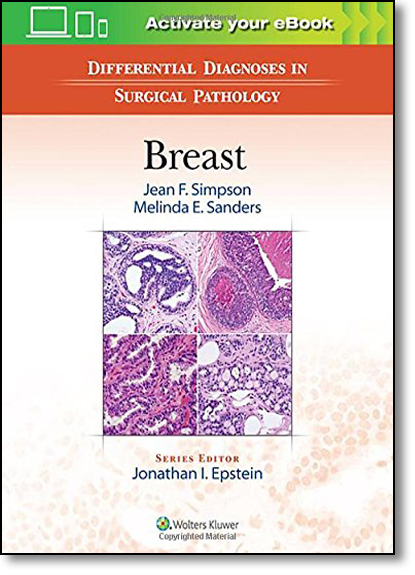 Differential Diagnoses in Surgical Pathology: Breast, livro de Melinda E. Sanders
