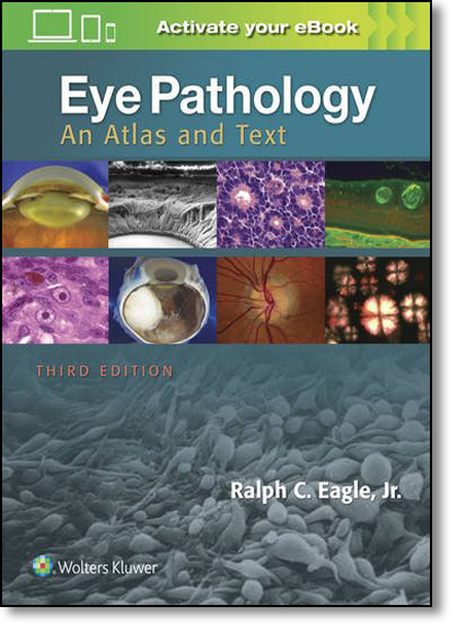 Eye Pathology: An Atlas and Text, livro de Ralph C. Eagle