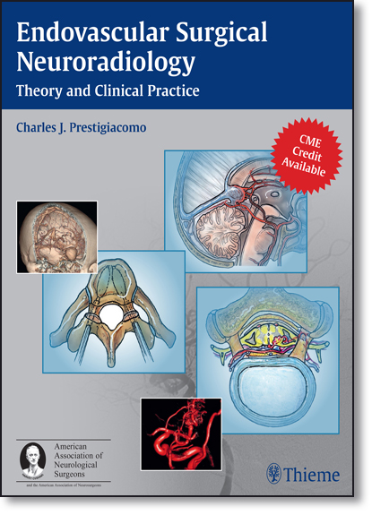 Endovascular Surgical Neuroradiology: Theory and Clinical Practice, livro de Charles Prestigiacomo