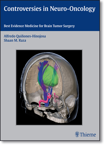 Controversies in Neuro-oncology: Best Evidence Medicine for Brain Tumor Surgery, livro de Alfredo Quinones-Hinojosa