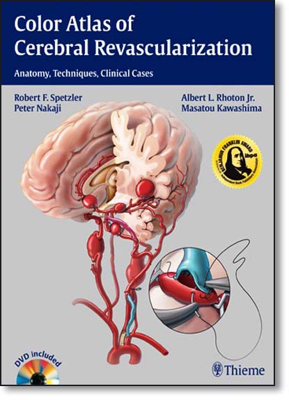 Color Atlas of Cerebral Revascularization: Anatomy, Techniques, Clinical Cases, livro de Robert F. Spetzler