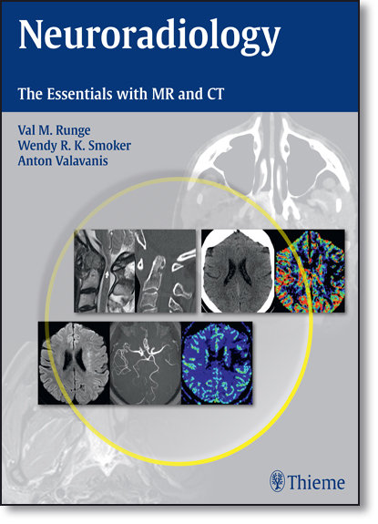 Neuroradiology: The Essentials With Mr and Ct, livro de Val Runge