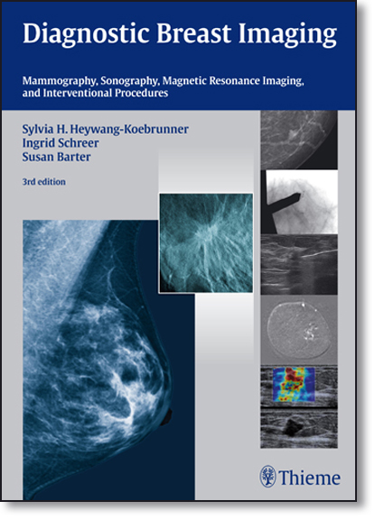 Diagnostic Breast Imaging: Mammography, Sonography, Magnetic Resonance Imaging, and Interventional Procedures, livro de Sylvia Heywang-Koebrunner