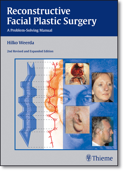 Reconstructive Facial Plastic Surgery: A Problem-solving Manual, livro de Hilko Weerda