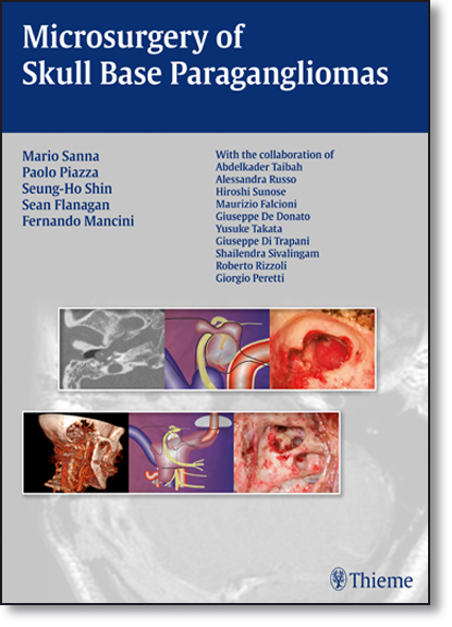 Microsurgery of Skull Base Paragangliomas, livro de Mario Sanna