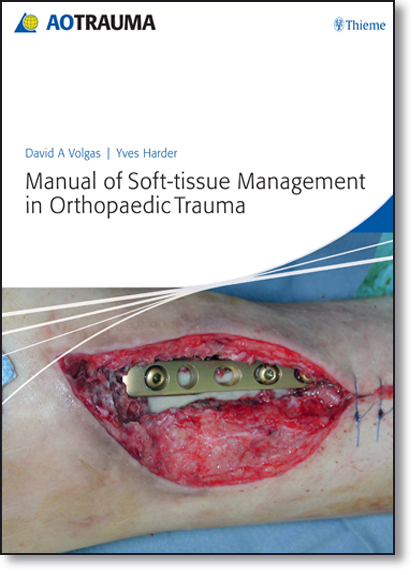 Manual of Soft-tissue Management in Orthopaedic Trauma, livro de David A. Volgas
