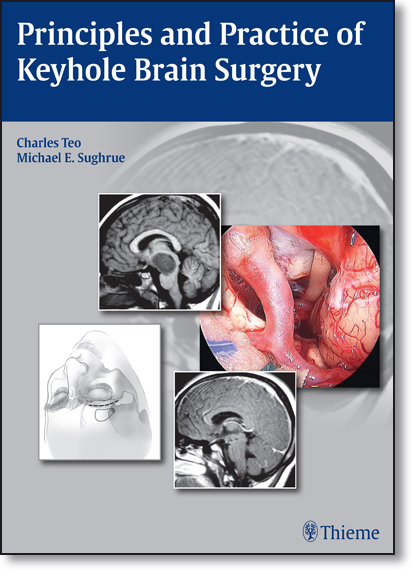 Principles and Practice of Keyhole Brain Surgery, livro de Charles Teo