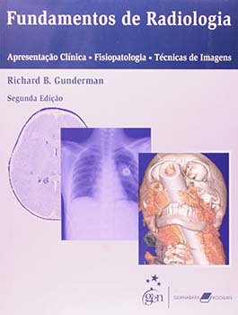 Fundamentos de radiologia - Apresentação clínica, fisiopatologia, técnicas de imagem - 2ª edição, livro de Richard B. Gunderman