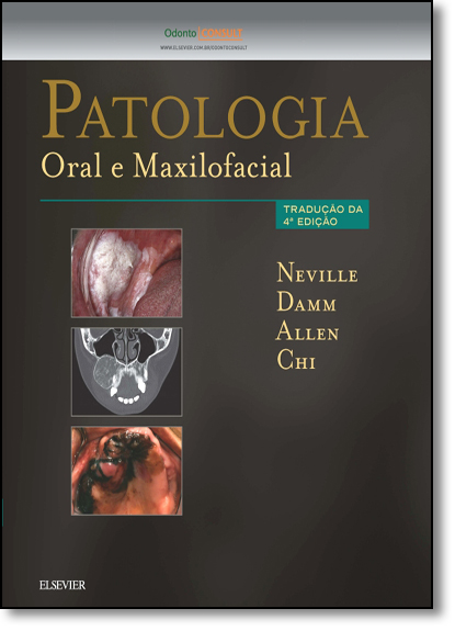 Patologia: Oral e Maxilofacial, livro de Brad Neville