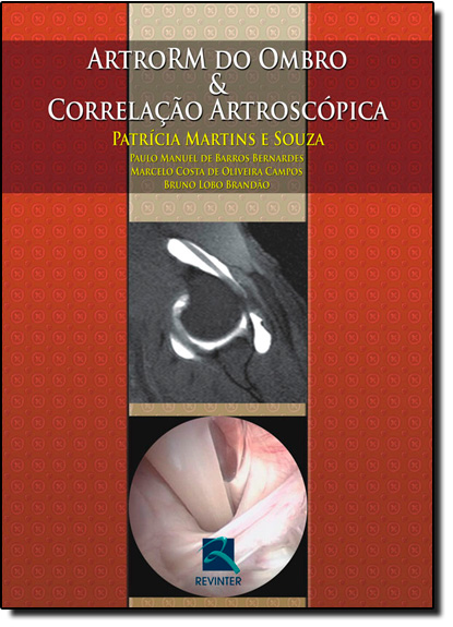 Artrorm do Ombro & Correlacao Artroscopica, livro de Patricia Souza