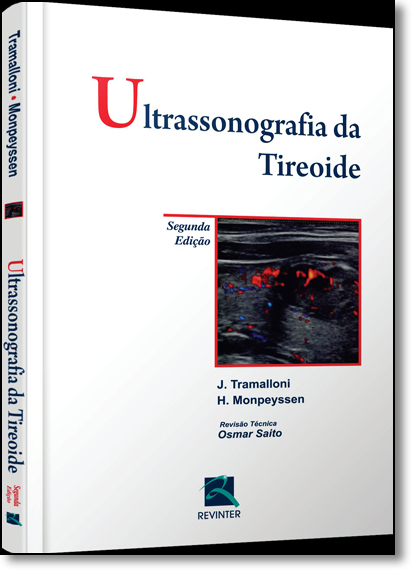 Ultrassonografia da Tireoide, livro de J. Tramalloni