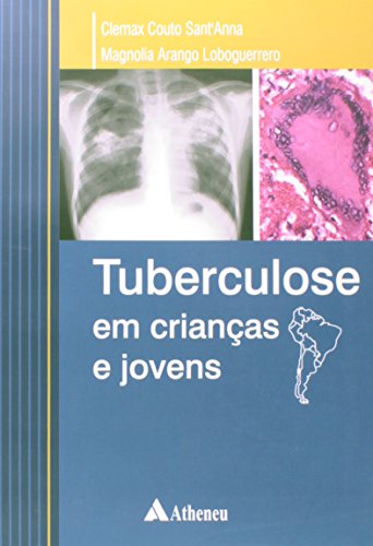 Tuberculose em Crianças e Jovens, livro de Clemax Couto Sant anna