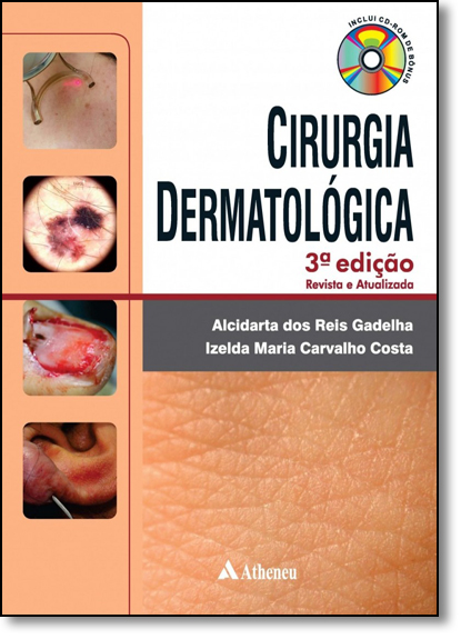 Cirurgia Dermatológica, livro de Alcidarta dos Reis Gadelha