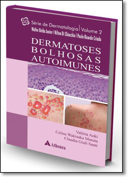 Dermatoses Bolhosas Autoimunes - Vol.2 - Série Dermatologia, livro de Walter Belda Junior