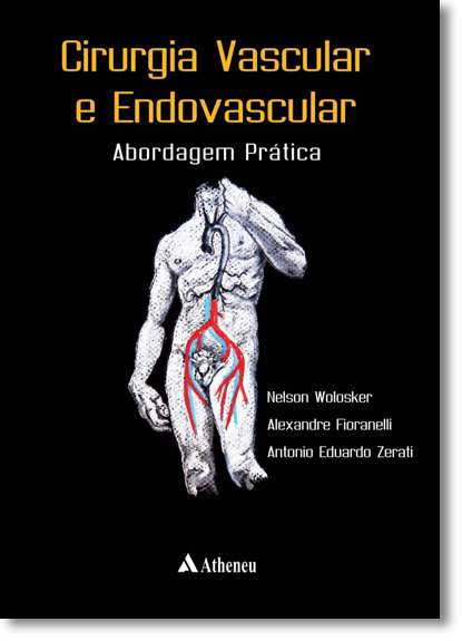 Cirurgia Vascular e Endovascular: Abordagem Prática, livro de Nelson Wolosker