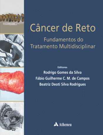 Câncer do Reto - Fundamentos do Tratamento Multidisciplinar, livro de Fabio Guilherme C.M Campos, Beatriz Deoti Silva Rodrigues, Rodrigo Gomes Silva