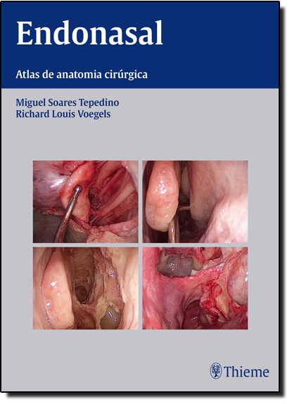 Endonasal: Atlas de Anatomia e Cirurgia Endoscópica dos, livro de Miguel Soares Tepedino