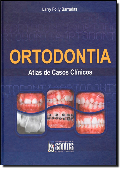 Ortodontia: Atlas de Casos Clínicos, livro de Larry Folly Barradas