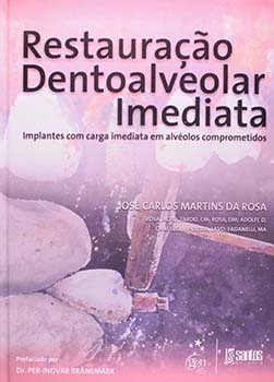 Restauração dentoalveolar imediata - Implantes com carga imediata em alvéolos comprometidos, livro de José Carlos Martins da Rosa