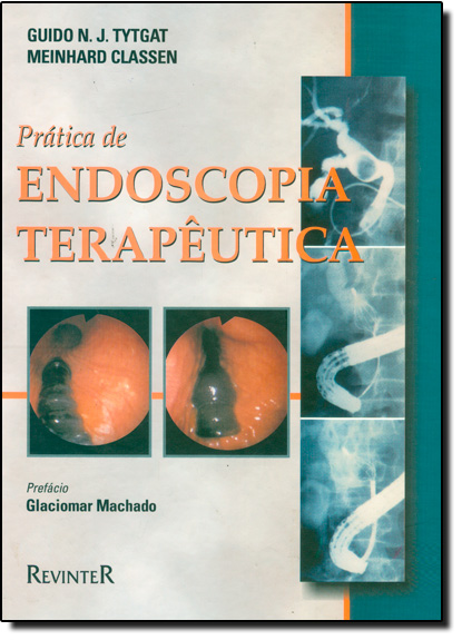 Prática de Endoscopia Terapêutica, livro de Guido N. J. Tytgat