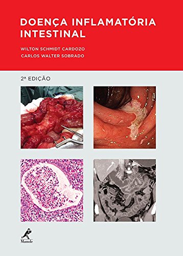 Doença Inflamatória Intestinal, livro de Cardozo, Wilton Schmidt / Sobrado, Carlos Walter 