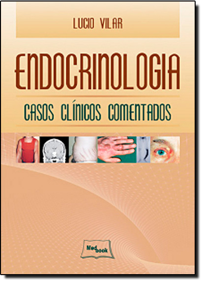 Endocrinologia: Casos Clínicos Comentados, livro de Lucio Vilar